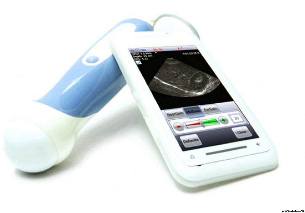 Мобильные устройства смогут ставить диагнозы