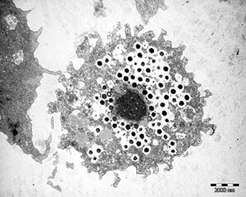 Ученые отнесли гигантские вирусы к промежуточной форме жизни